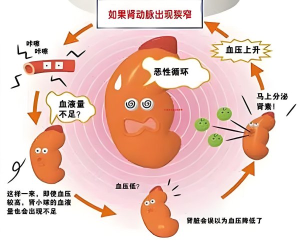 倍加网配资 高血压吃了降压药,血压降不下来怎么办?医生支招